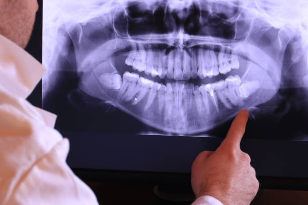 Best Broken or Cracked Tooth Emergency Dentist in Upton, WY