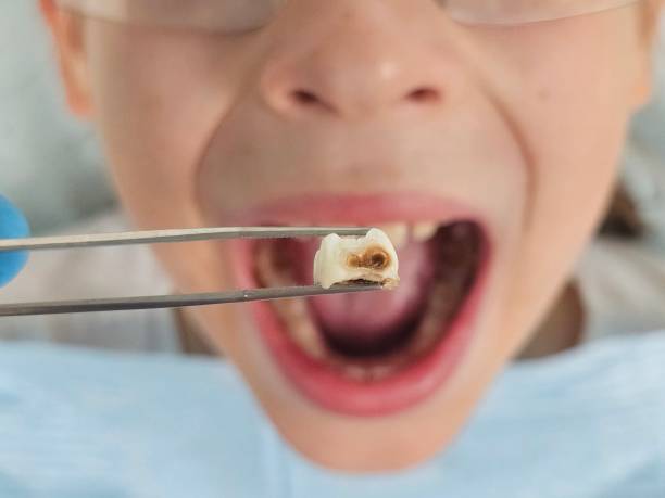 Best Weekend Emergency Dentist in Upton, WY